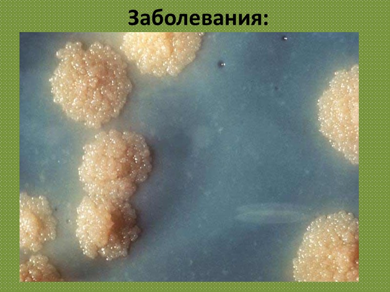 Заболевания:  Туберкулёз — инфекционное заболевание человека и животных. Туберкулёз обычно поражает лёгкие, реже